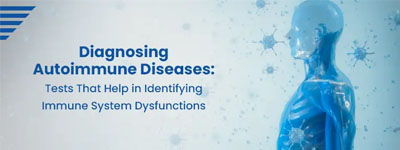 Diagnosing Autoimmune Diseases: Tests That Help in Identifying Immune System Dysfunctions