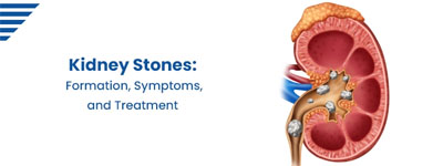 Kidney Stones: Formation, Symptoms, and Treatment