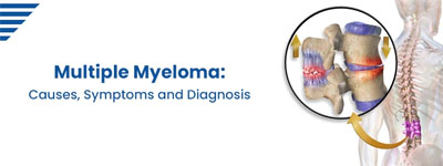 Multiple Myeloma: Causes, Symptoms and Diagnosis