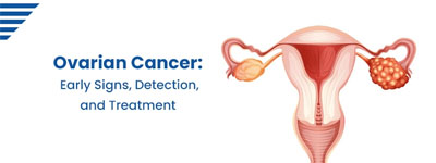 Ovarian Cancer: Early Signs, Detection, and Treatment