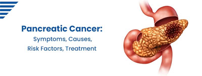 Pancreatic Cancer: Symptoms, Causes, Risk Factors, Treatment