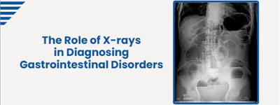 The Role of X-rays in Diagnosing Gastrointestinal Disorders