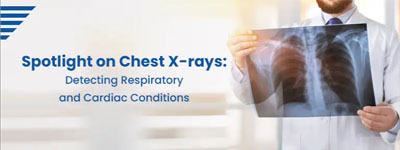 Spotlight on Chest X-rays: Detecting Respiratory and Cardiac Conditions