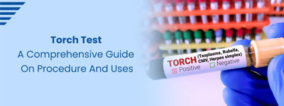 TORCH Test A Comprehensive Guide on Procedure and Uses