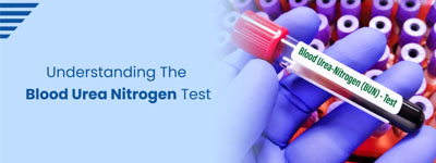 Understanding the Blood Urea Nitrogen (BUN) Test