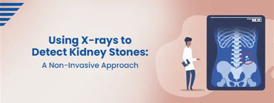 Using X-rays to Detect Kidney Stones: A Non-Invasive Approach