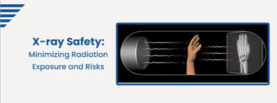 X-ray Safety: Minimizing Radiation Exposure and Risks