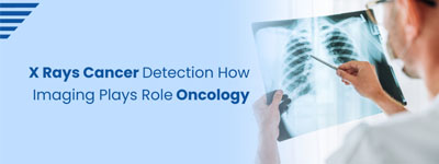 X-rays and Cancer Detection: How Imaging Plays a Role in Oncology