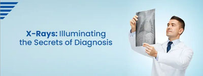 X-Rays: Illuminating the Secrets of Diagnosis