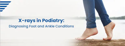 X-rays in Podiatry: Diagnosing Foot and Ankle Conditions