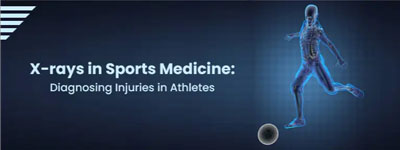 X-rays in Sports Medicine: Diagnosing Injuries in Athletes