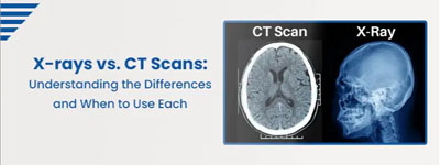 X-rays vs. CT Scans: Understanding the Differences and When to Use Each