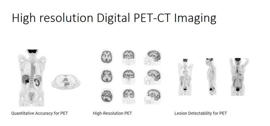 Digital PET CT Imaging