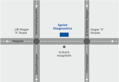 Sprint Diagnostics LB Nagar